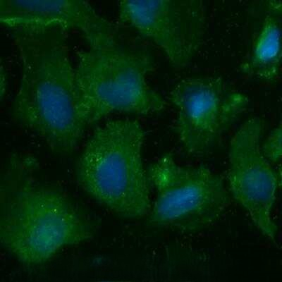SSTR2 Antibody in Immunocytochemistry (ICC/IF)
