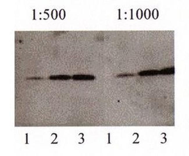 beta Amyloid (1-42) Antibody in Western Blot (WB)