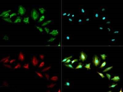 ABCF2 Antibody in Immunocytochemistry (ICC/IF)