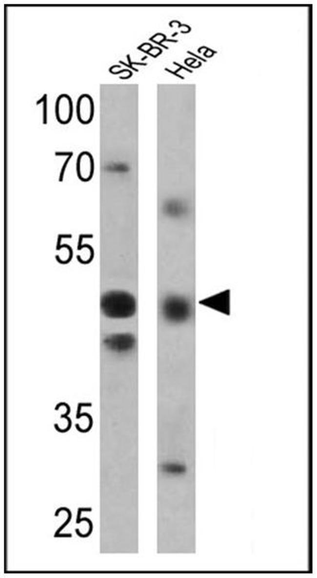 RAR gamma-2 Antibody in Western Blot (WB)