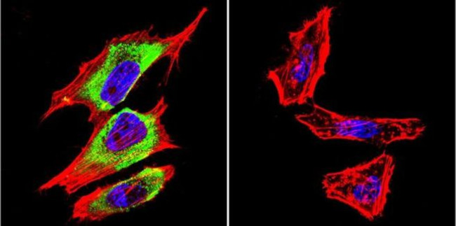 PDX1 Antibody in Immunocytochemistry (ICC/IF)