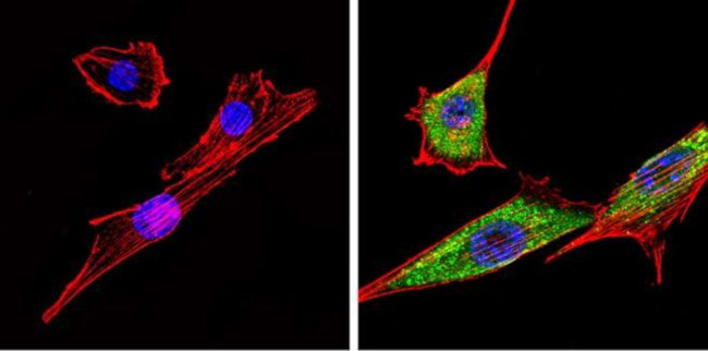Transferrin Antibody in Immunocytochemistry (ICC/IF)