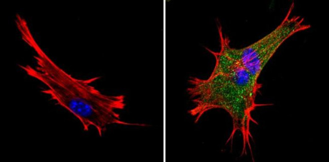 XPC Antibody in Immunocytochemistry (ICC/IF)