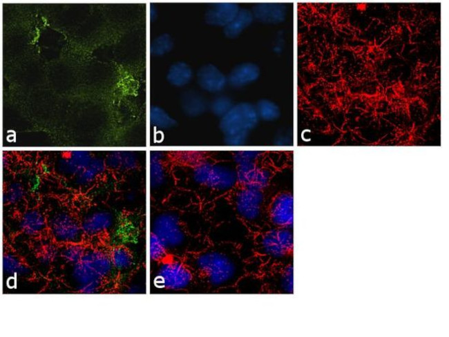 CRMP2 Antibody in Immunocytochemistry (ICC/IF)