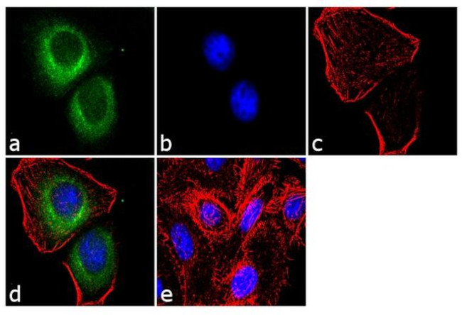 CCKBR Antibody in Immunocytochemistry (ICC/IF)