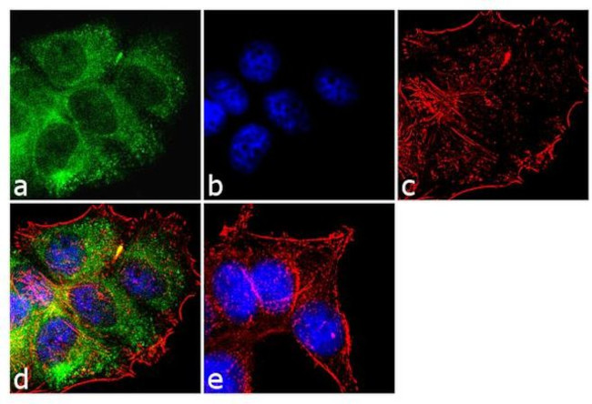 PTH1R Antibody in Immunocytochemistry (ICC/IF)
