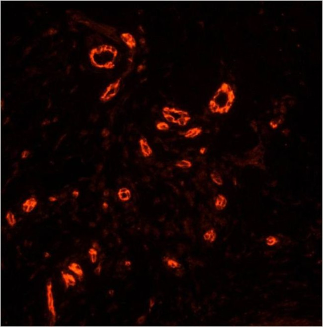 TACR1 Antibody in Immunohistochemistry (Paraffin) (IHC (P))