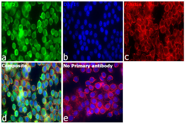 IFIT2 Antibody in Immunocytochemistry (ICC/IF)