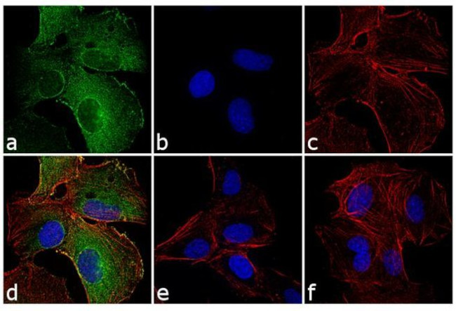 IFIT1 Antibody in Immunocytochemistry (ICC/IF)