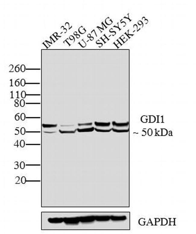 GDI1 Antibody in Western Blot (WB)