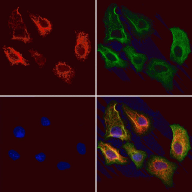 RNaseH1 Antibody in Immunocytochemistry (ICC/IF)