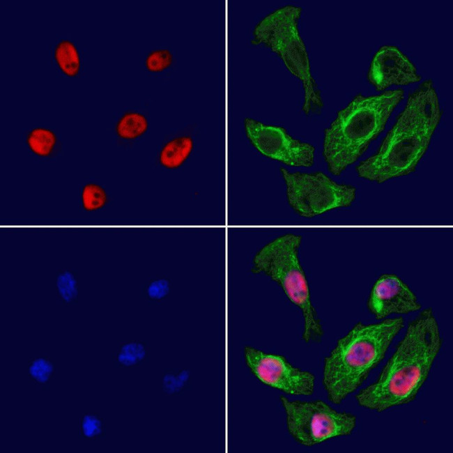 BRD7 Antibody in Immunocytochemistry (ICC/IF)