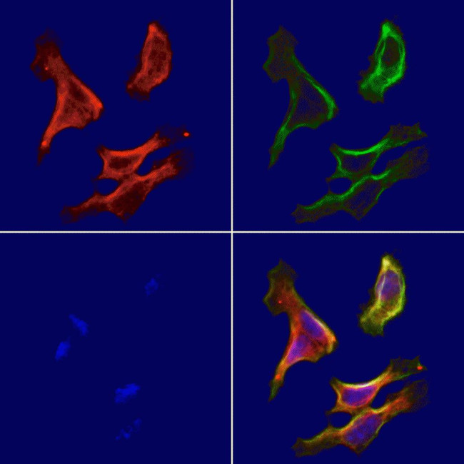 SUCLA2 Antibody in Immunocytochemistry (ICC/IF)