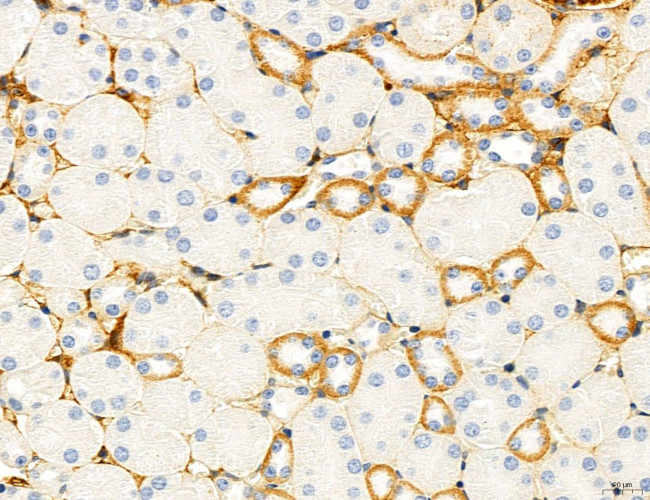 ATP Synthase B1 Antibody in Immunohistochemistry (Paraffin) (IHC (P))