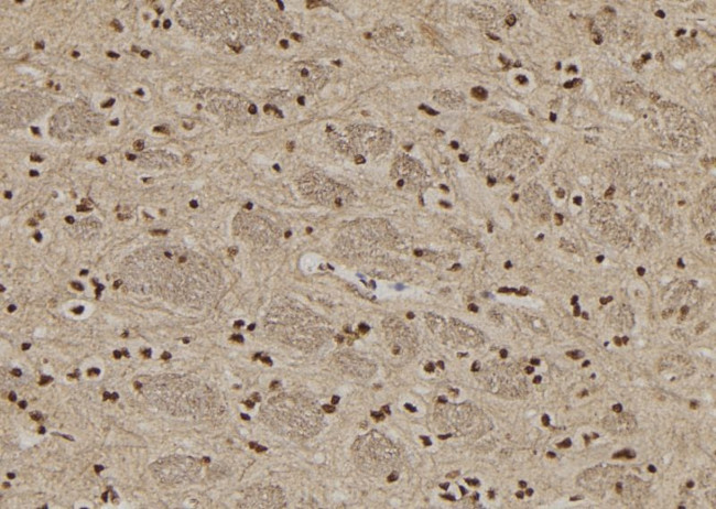 Coilin Antibody in Immunohistochemistry (Paraffin) (IHC (P))