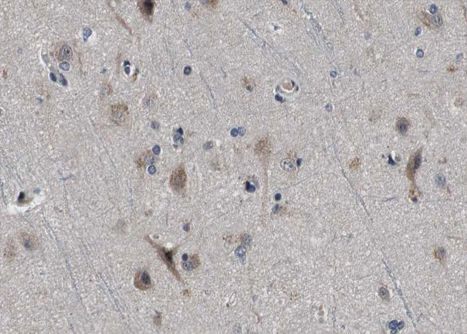 CPT1C Antibody in Immunohistochemistry (Paraffin) (IHC (P))