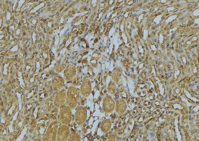 Myosin 4 Antibody in Immunohistochemistry (Paraffin) (IHC (P))