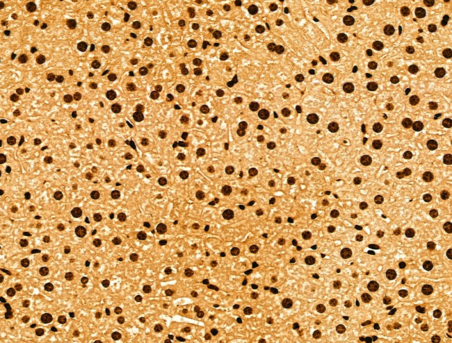 YTHDF2 Antibody in Immunohistochemistry (Paraffin) (IHC (P))