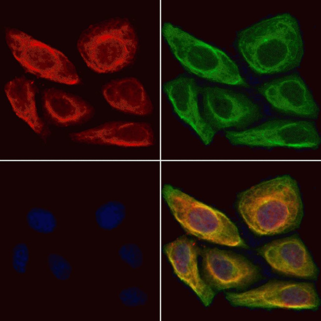 CKAP4 Antibody in Immunocytochemistry (ICC/IF)