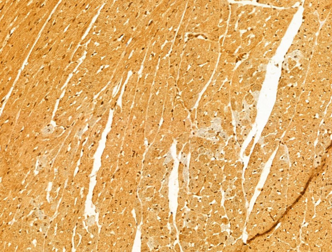 MTO1 Antibody in Immunohistochemistry (Paraffin) (IHC (P))