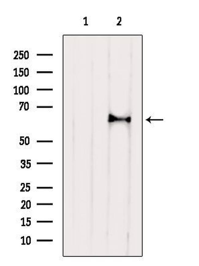 ASAH1 Antibody in Western Blot (WB)
