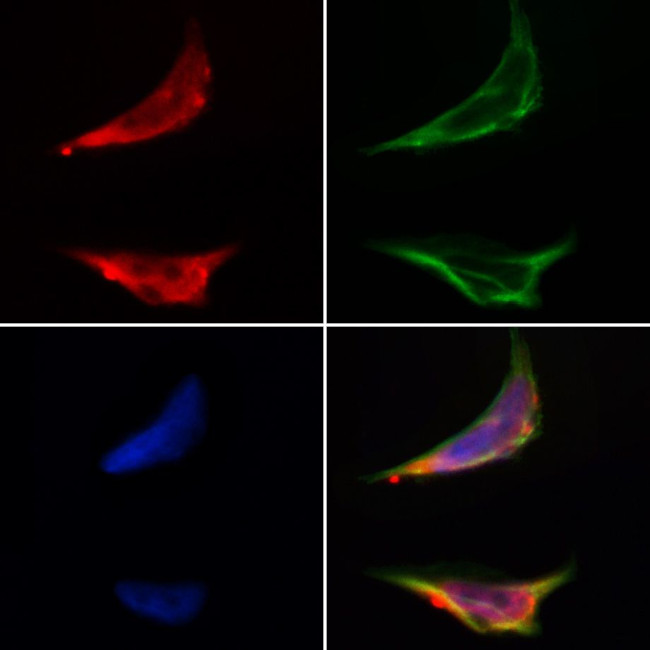CMIP Antibody in Immunocytochemistry (ICC/IF)