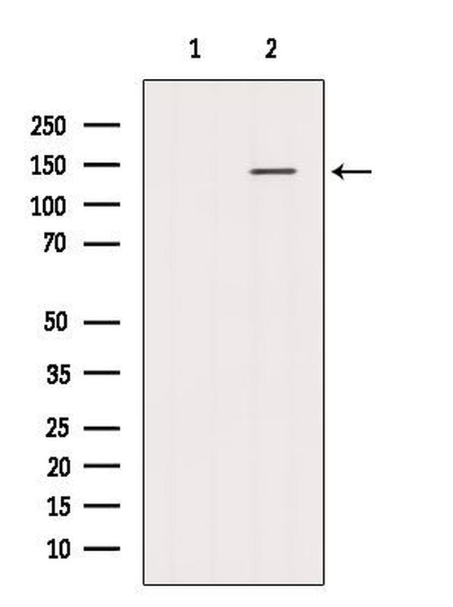 HPS5 Antibody in Western Blot (WB)