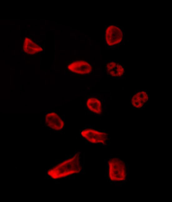 MAGOH Antibody in Immunocytochemistry (ICC/IF)