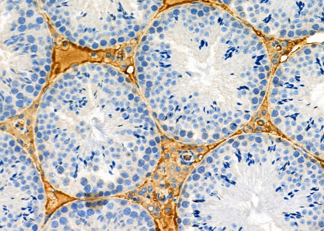 MPZL2 Antibody in Immunohistochemistry (Paraffin) (IHC (P))