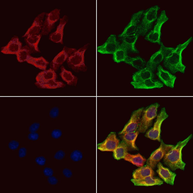 TRIM9 Antibody in Immunocytochemistry (ICC/IF)