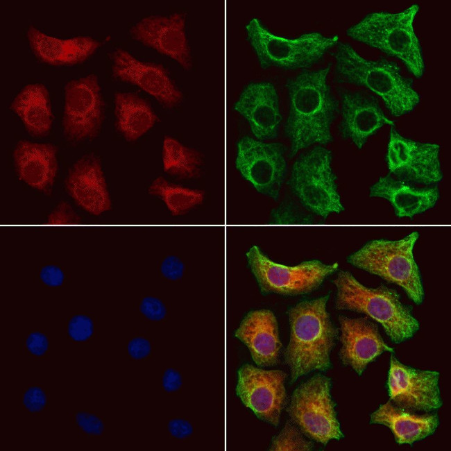 D4-GDI Antibody in Immunocytochemistry (ICC/IF)
