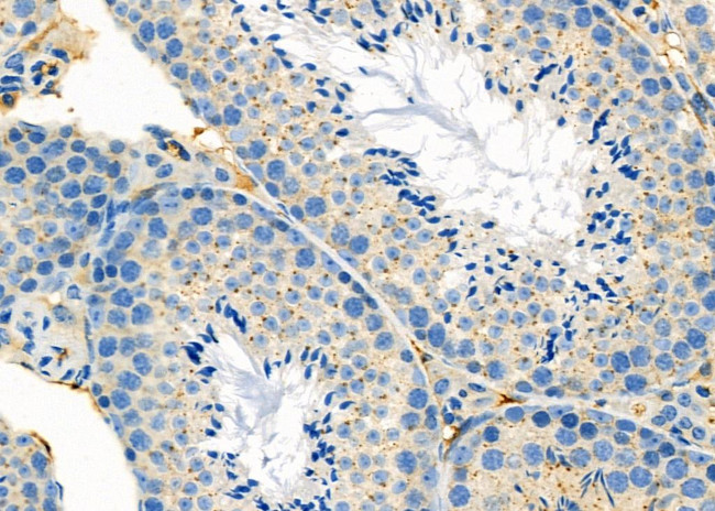 ARL8B Antibody in Immunohistochemistry (Paraffin) (IHC (P))