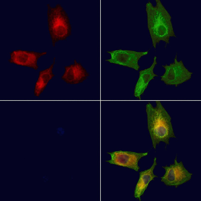 BBS10 Antibody in Immunocytochemistry (ICC/IF)