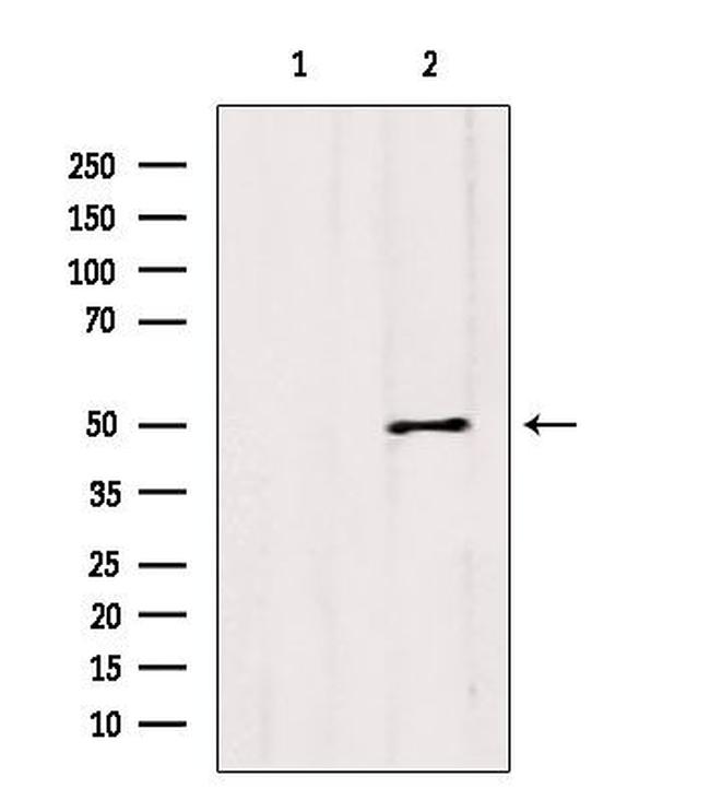 CCBL1 Antibody in Western Blot (WB)