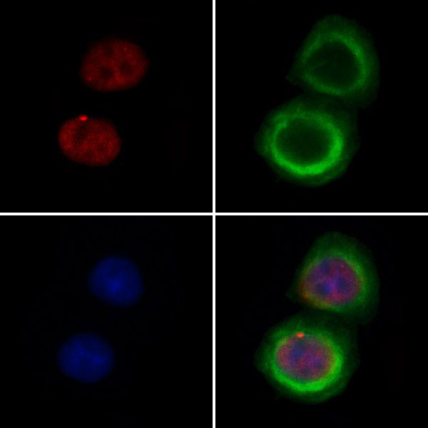 CNOT10 Antibody in Immunocytochemistry (ICC/IF)