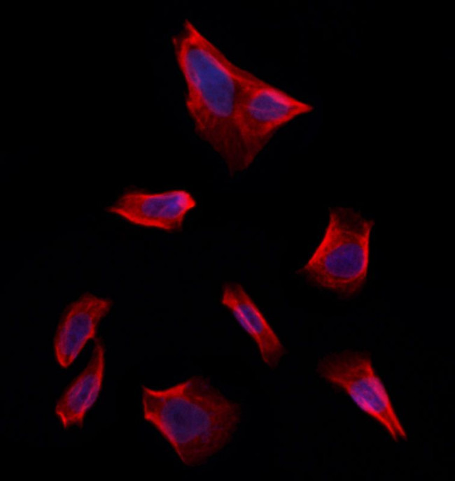 FBXO22 Antibody in Immunocytochemistry (ICC/IF)