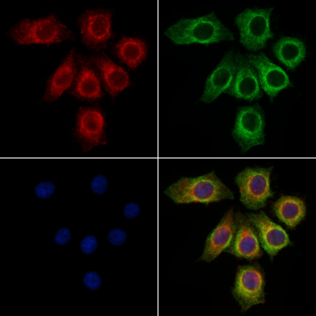 ITLN1 Antibody in Immunocytochemistry (ICC/IF)