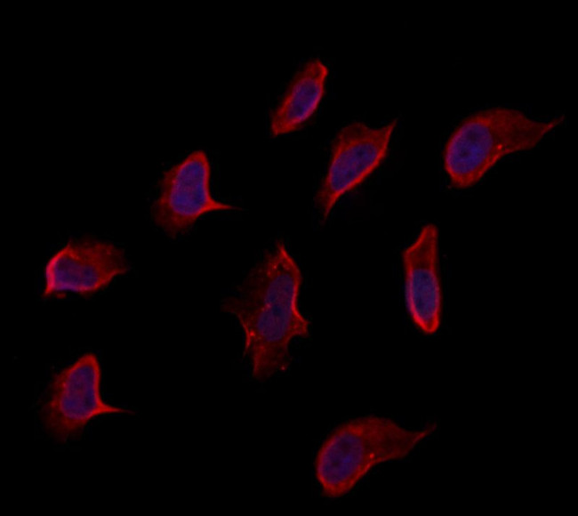 eIF2d Antibody in Immunocytochemistry (ICC/IF)