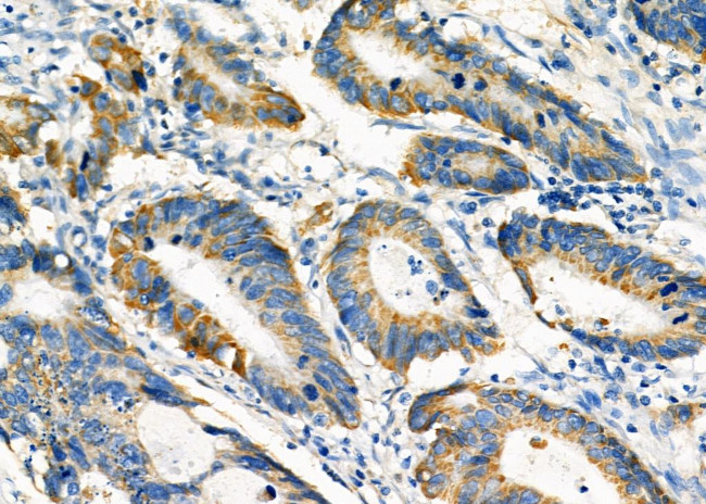 PCCA Antibody in Immunohistochemistry (Paraffin) (IHC (P))