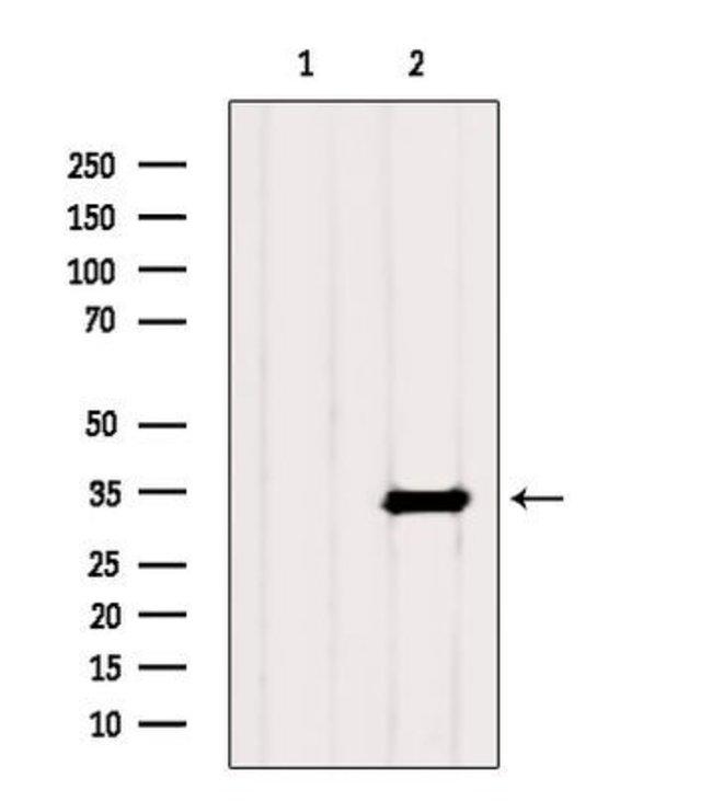 PHF11 Antibody in Western Blot (WB)