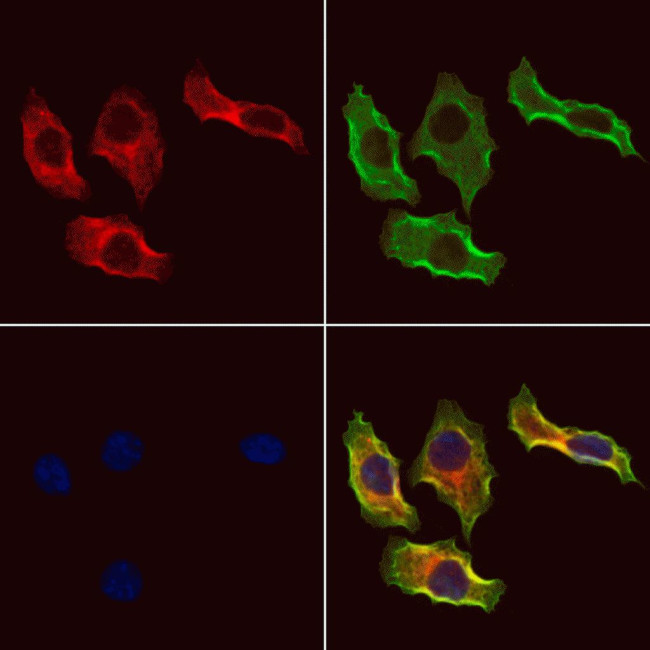 PIK3IP1 Antibody in Immunocytochemistry (ICC/IF)