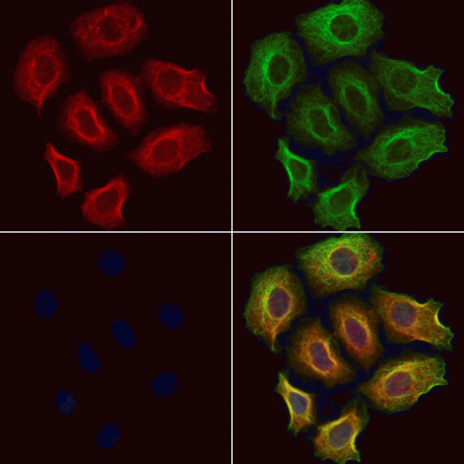 ZFYVE16 Antibody in Immunocytochemistry (ICC/IF)
