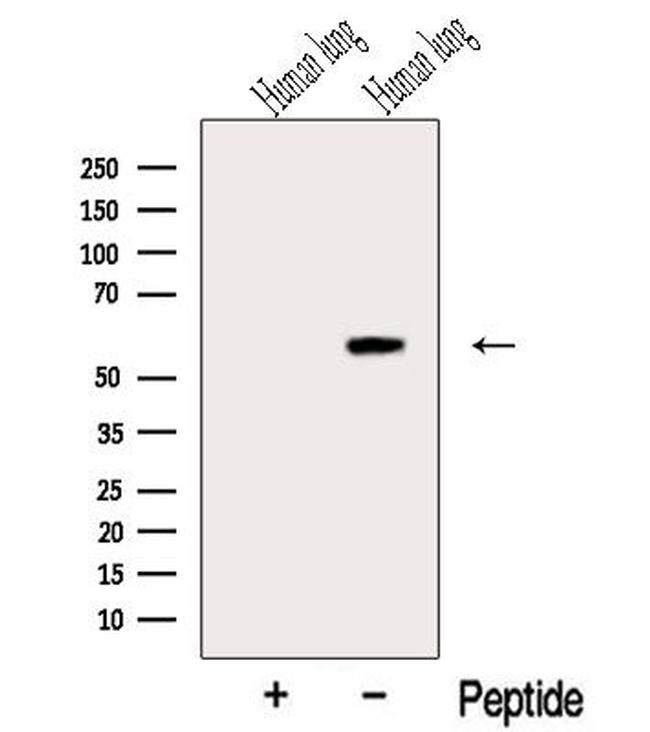 RASSF10 Antibody in Western Blot (WB)