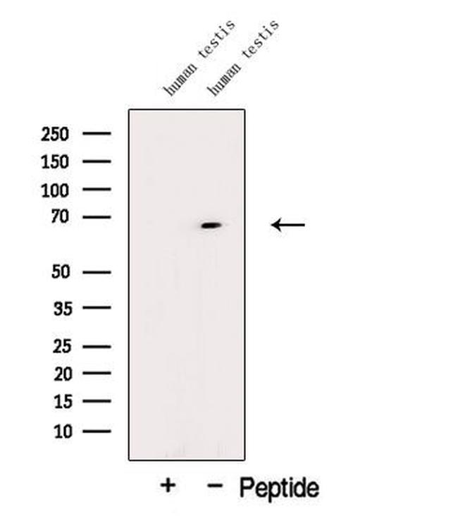 DTX2 Antibody in Western Blot (WB)