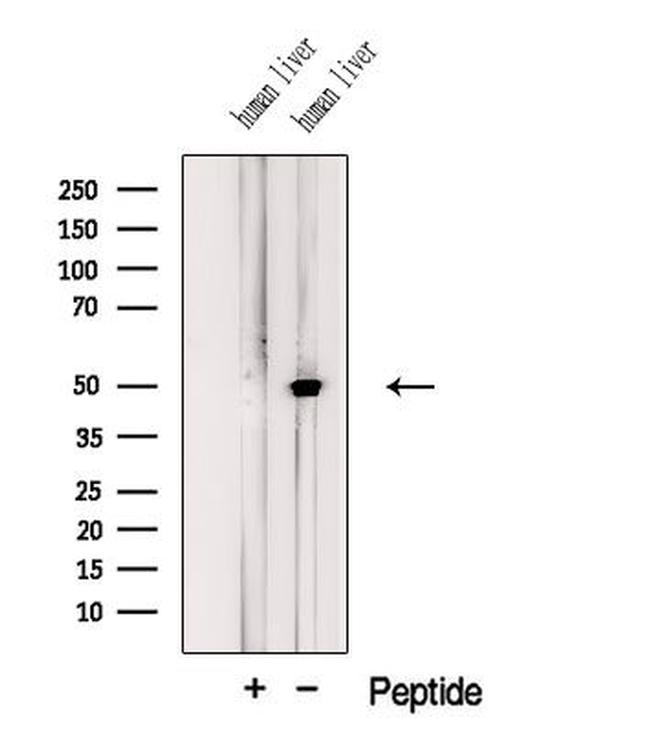 JMJD5 Antibody in Western Blot (WB)
