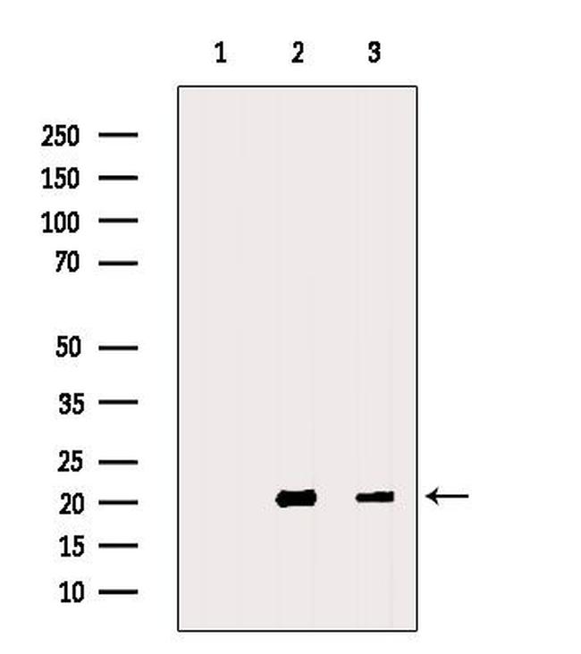 MFAP5 Antibody in Western Blot (WB)
