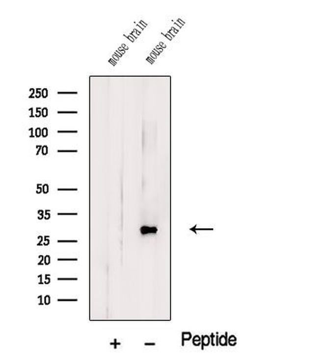 TMEM9 Antibody in Western Blot (WB)