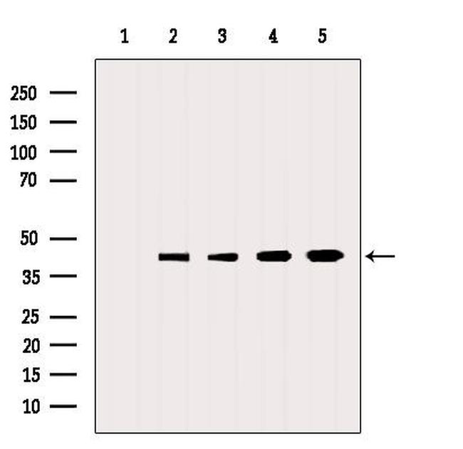 Neuritin Antibody in Western Blot (WB)