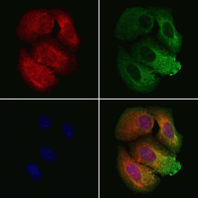 BBS9 Antibody in Immunocytochemistry (ICC/IF)