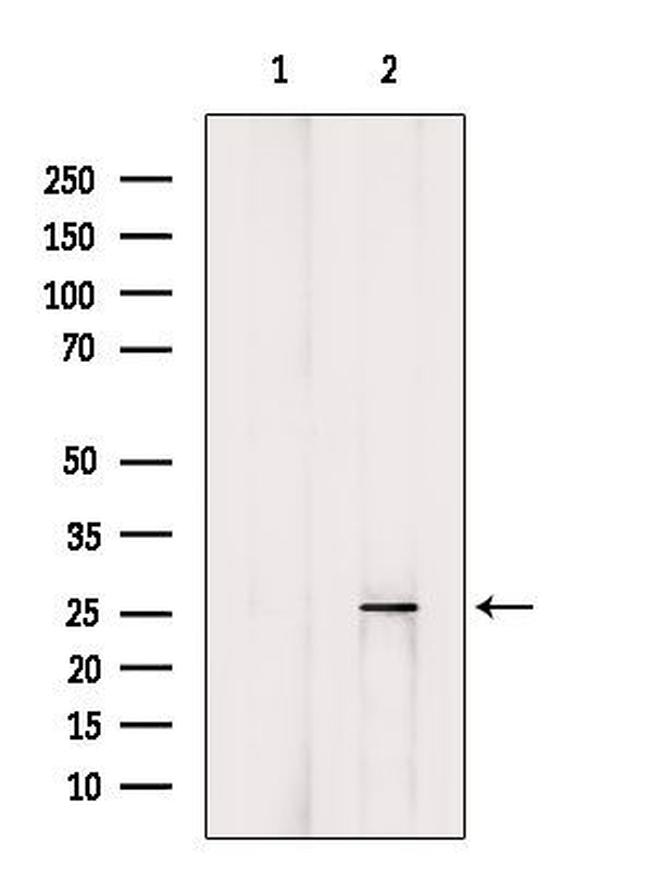 BTG1 Antibody in Western Blot (WB)